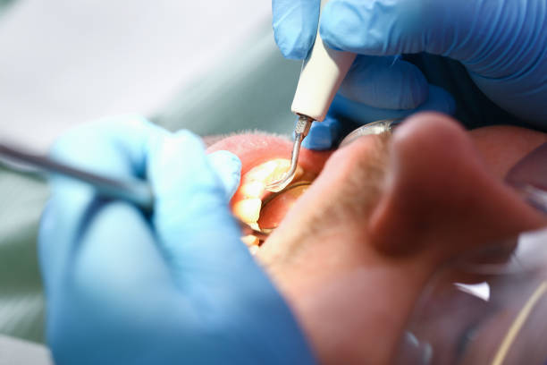 Best Emergency Dental Surgery in Nicollet, MN