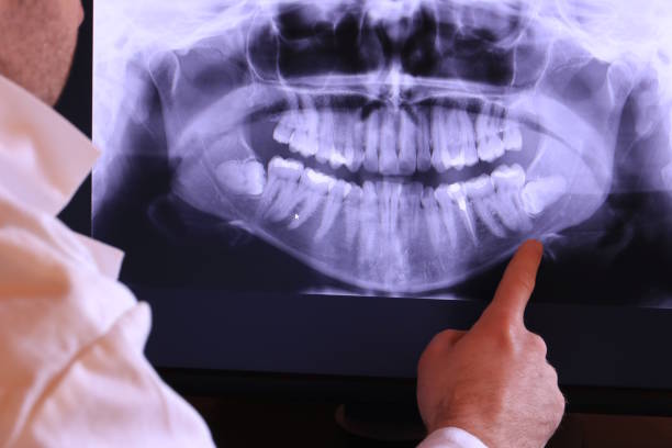 Best Emergency Tooth Extraction in Nicollet, MN